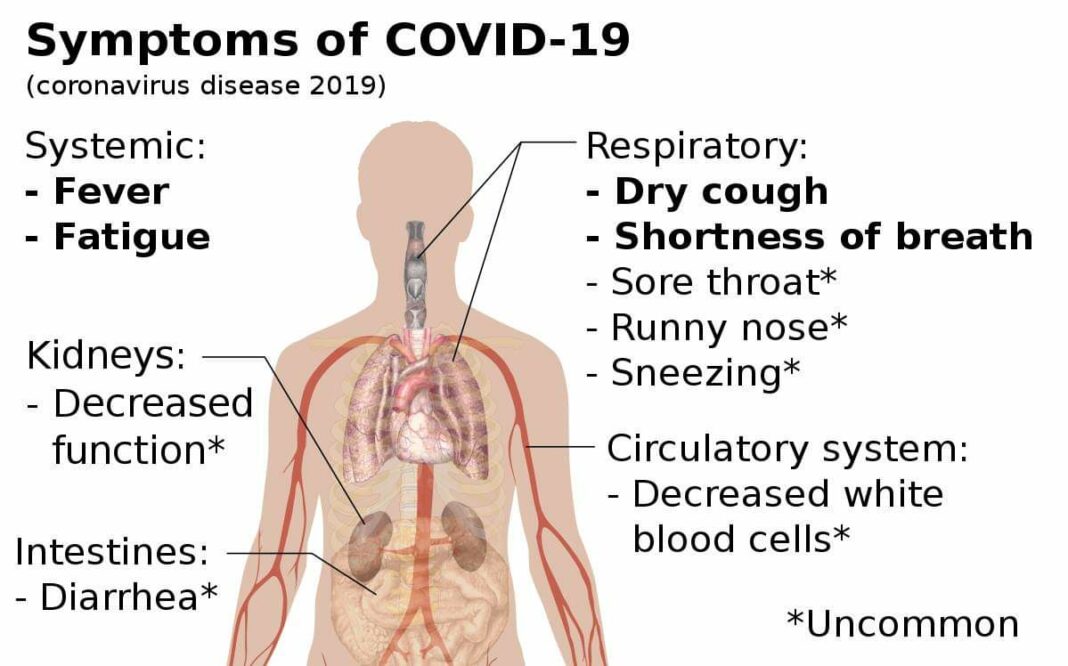 Occident – Gestion médiocre et tardive de la crise du Coronavirus (*). L&rsquo;heure devrait être à un dépistage massif et obligatoire.