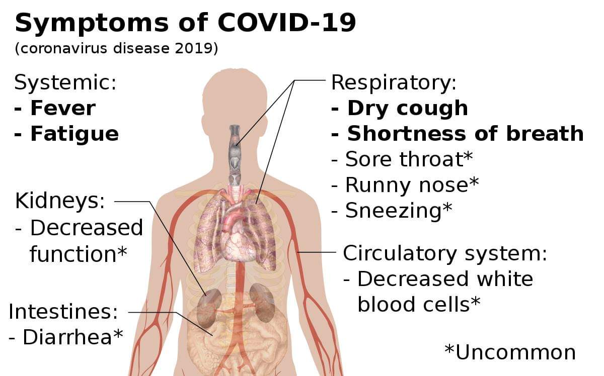 Occident - Gestion médiocre et tardive de la crise du Coronavirus (*). L'heure devrait être à un dépistage massif et obligatoire.
