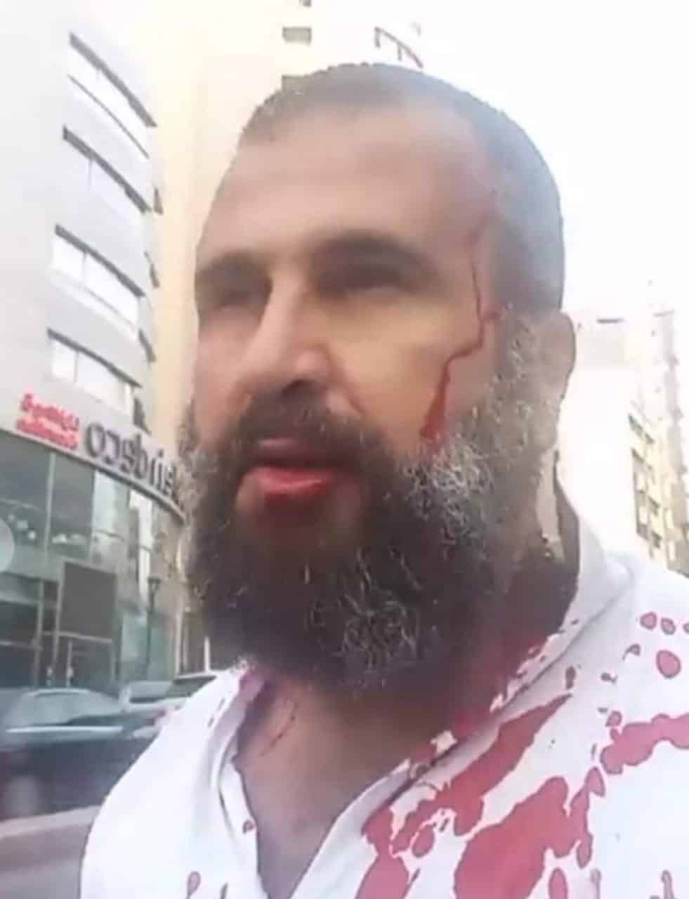 L'avocat et activiste Wassef Haraké agressé devant la Radio VDL
