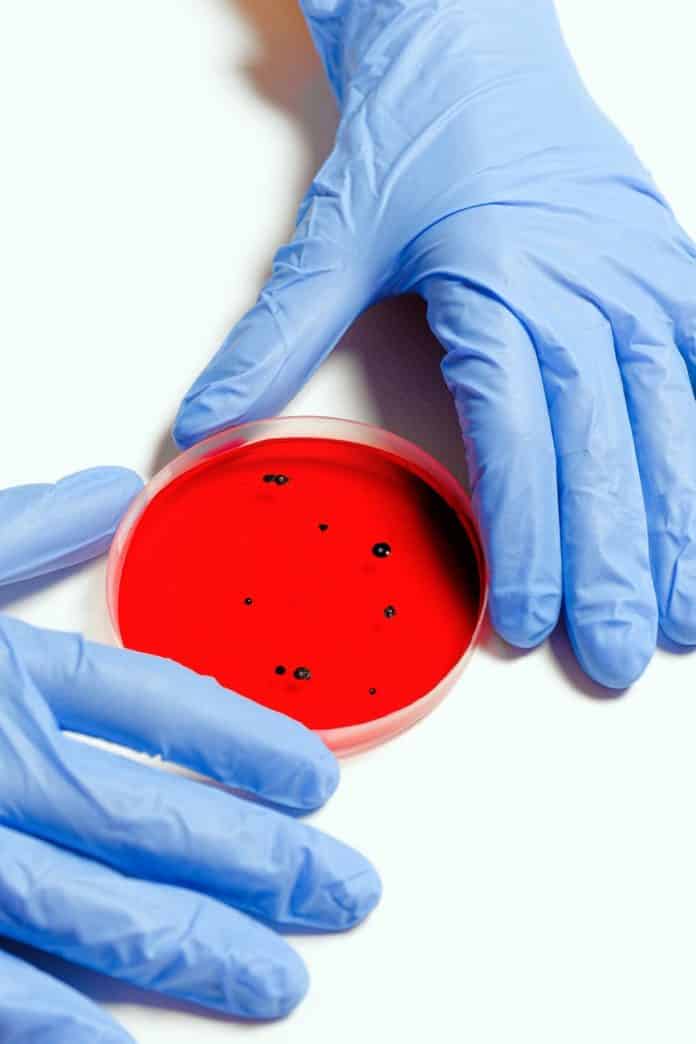 pexels-photo-3786247 scientist holding petri dish