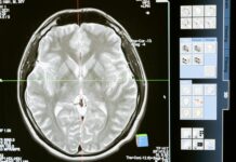 technology computer head health