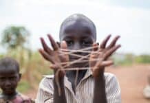 boy showing hand with rubber